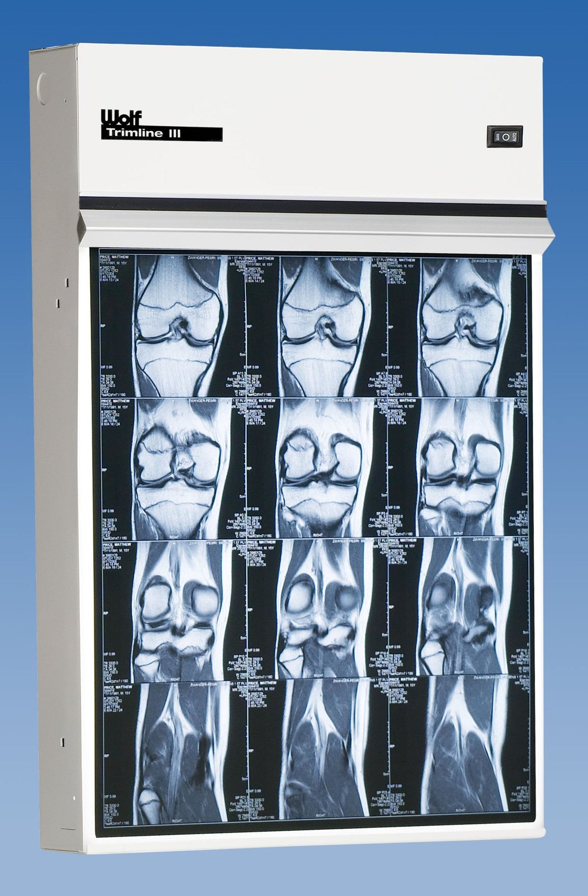 Trimline III Illuminator