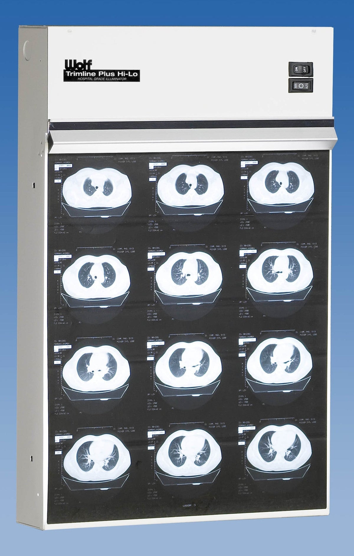Trimline Plus Illuminator