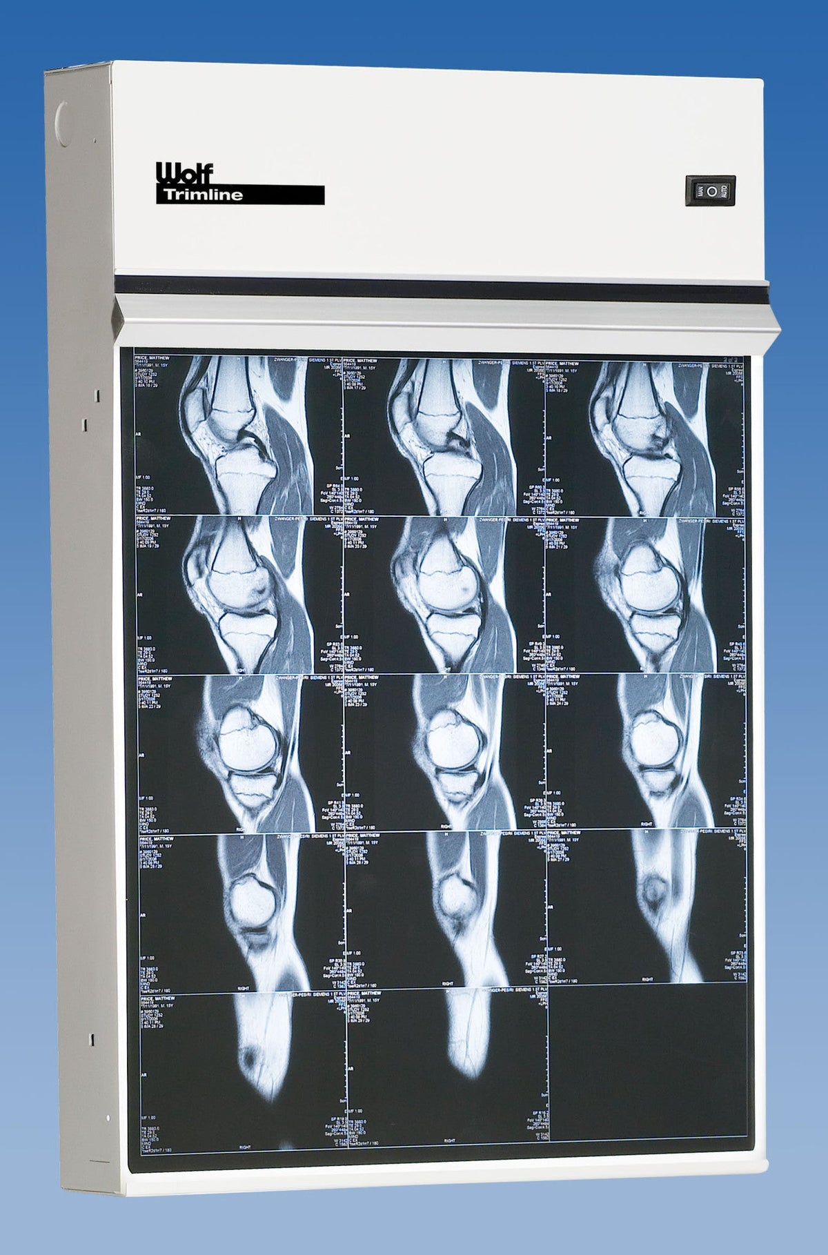 Wolf X-Ray Replacement Part: Trimline 5-in-1 PLEXI 1/8 X 16-7/8 X 70 1/16