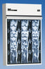 Trimline III Illuminator Series , 3 Bulbs per viewing area, - Automatic Switchng, No Leakage, Instant Ballast - Surface Mounting Only 5 over 5 220V