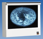 Wolf X-Ray VU-PLUS Mammography Double Bank Illuminator 4 film viewing