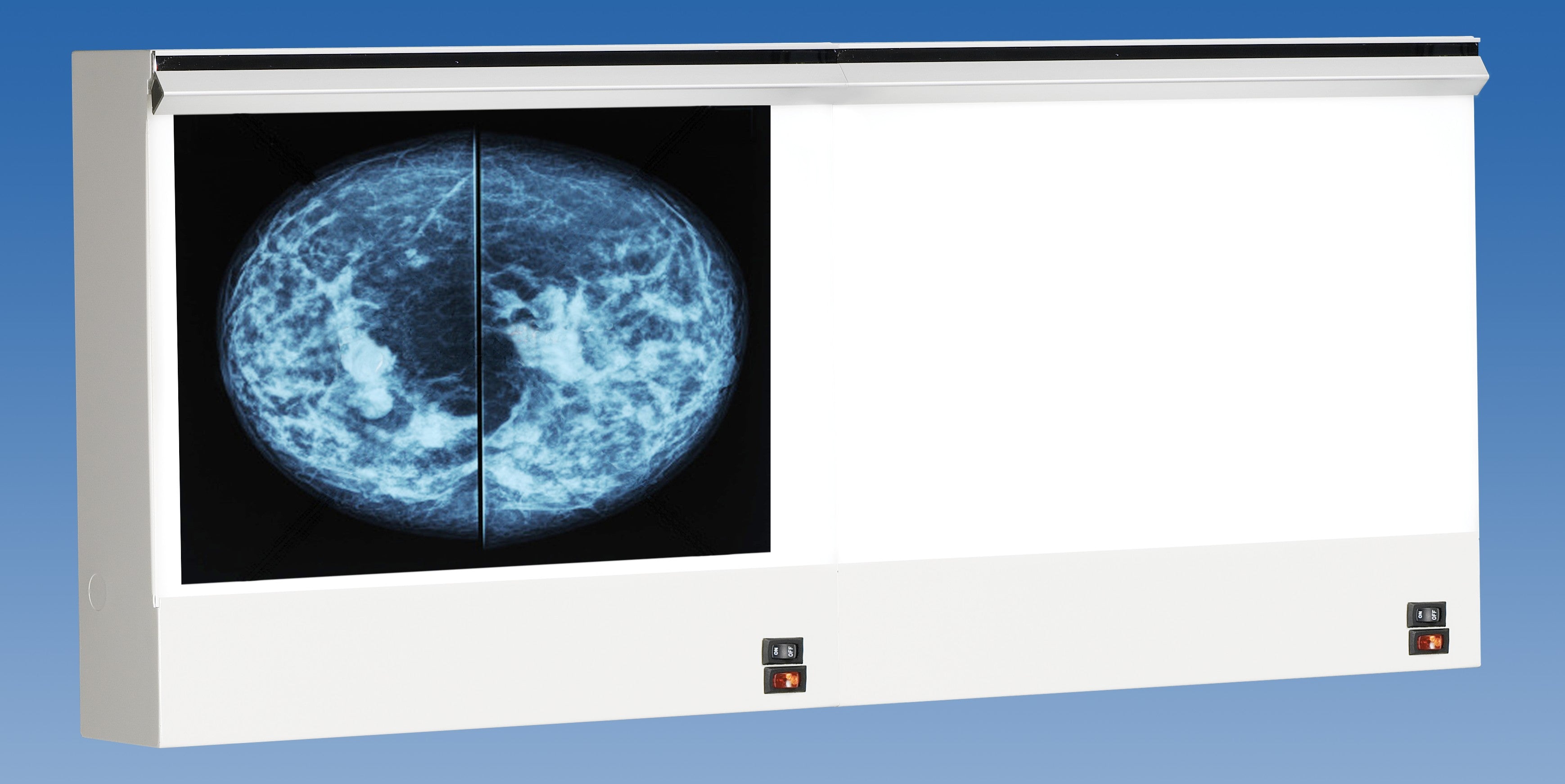 VU-PLUS Mammography Double Bank Illuminator 4 film viewing - View 1