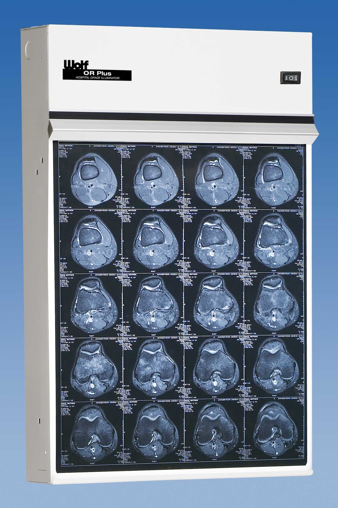 Trimline Plus Illuminator Secondary image