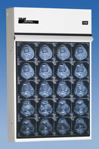 Trimline Plus Illuminator - View 1