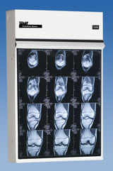 Trimline Basic Illuminator