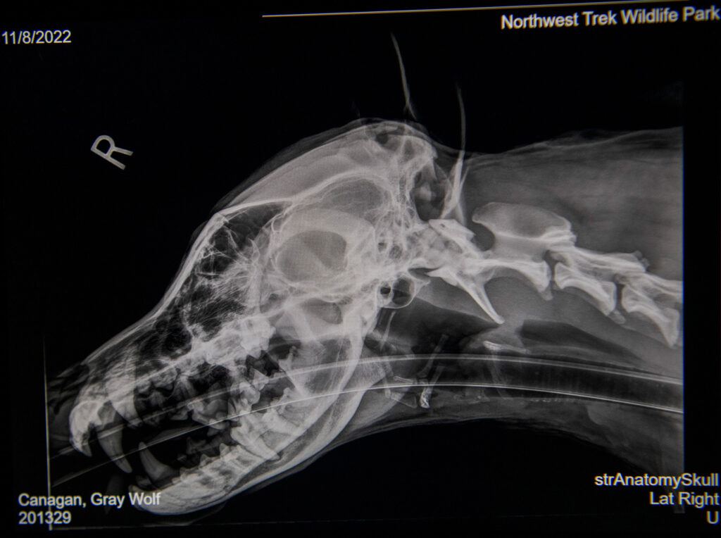 Wolf X-Ray 2D ANALOG AREA OF CONCERN/ NON-PALPABLE MASS