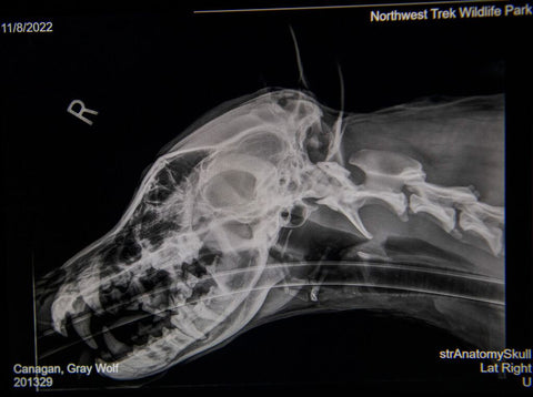 Wolf X-Ray 2D ANALOG AREA OF CONCERN/ NON-PALPABLE MASS
