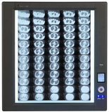 Trimline LED Single
